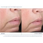 Extra Strength Active Peel Brightening System