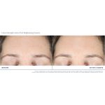 Extra Strength Active Peel Brightening System